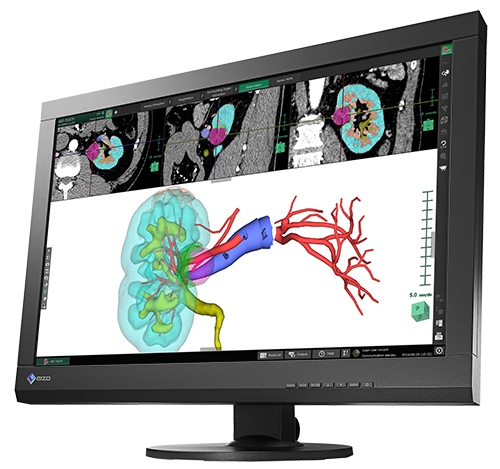 EIZO RadiForce MX242