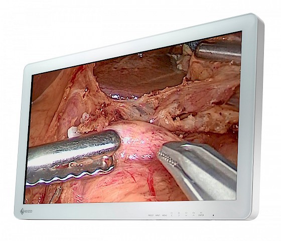 EIZO RadiForce EX2620