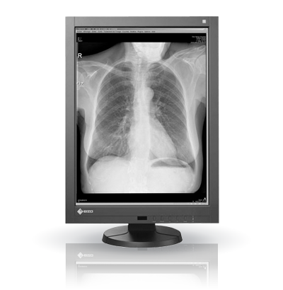 EIZO RadiForce GX340