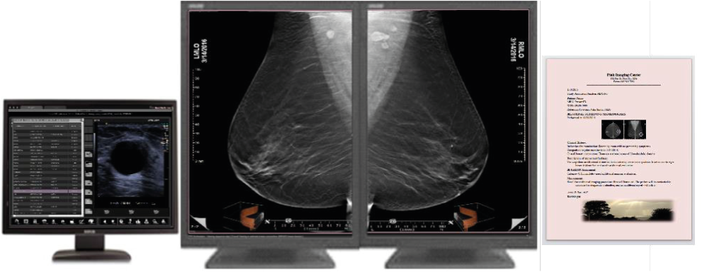 Three Palm Software - Oprogramowanie do skriningu i diagnostyki w mammografii