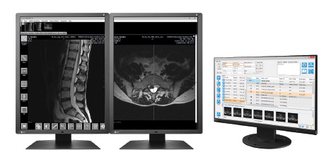 IQ-VIEW / PRO - Stacja do odczytu badań radiologicznych